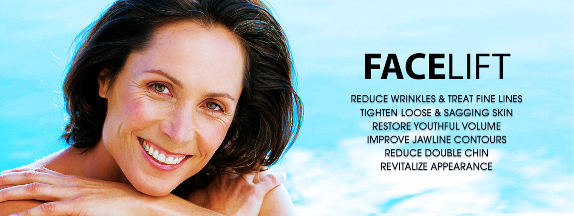 Facelift Benefits