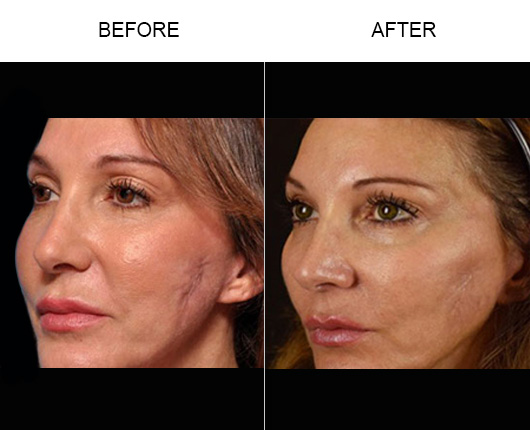 face of mars before and after face of mars before and after