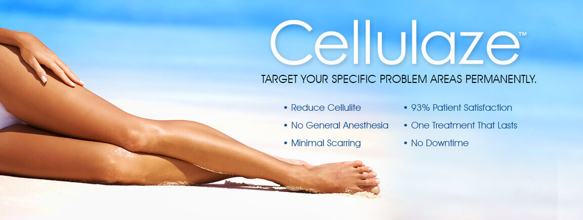 Cellulaze Florida, Treatment for Cellulite Orlando, Cellulite