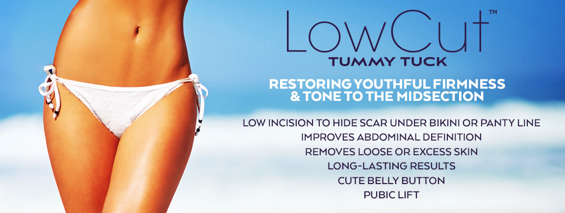 LowCut Tummy Tuck Procedure